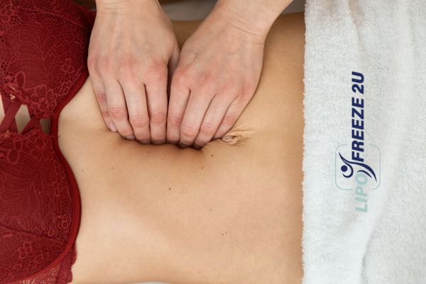 diastasis recti treatment High Wycombe