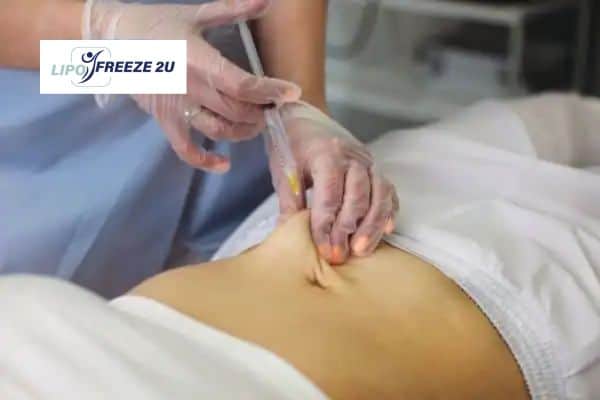 How Does Aqualyx Fat Dissolving Injection Work to Break Down Fat High Wycombe?