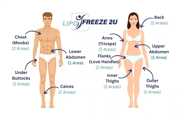 Areas you can have fat freezing treatment High Wycombe
