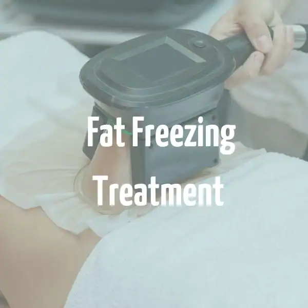 fat freezing treatment High Wycombe